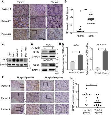 GRB7-mediated enhancement of cell malignant characteristics induced by Helicobacter pylori infection